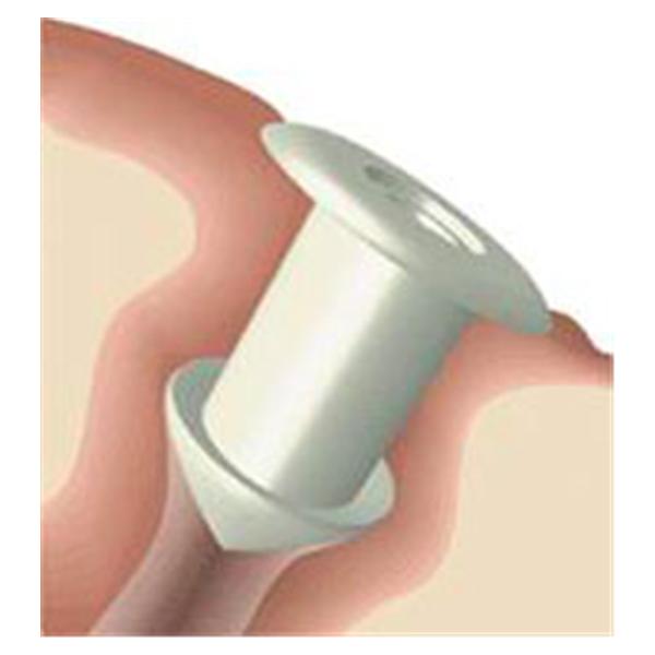 Plug Punctal Flow Control Soft Plug Silicone 0.6mm 2/Pr