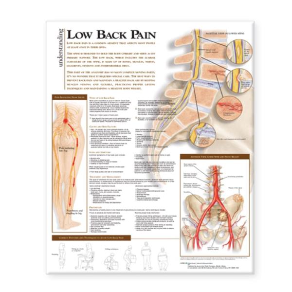 Chart Anatomical Understanding Lower Back Pain 20x26\