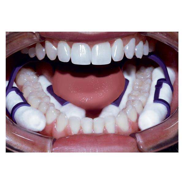 Cotton Roll Holder Isolators Purple 50/Box