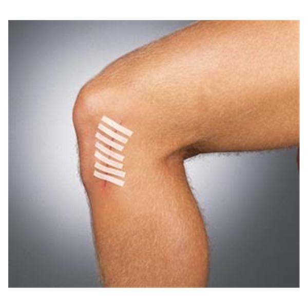 Strip Wound Closure Suture Strip 1/4x1-1/2
