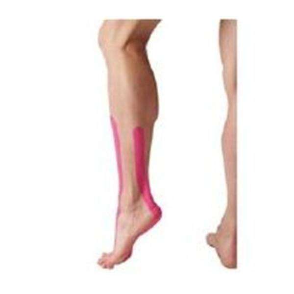 Tape Kinesiology SpiderTech 100% Cotton/Poly Acrylic Pre Cut Adhesive Pink 5/Box