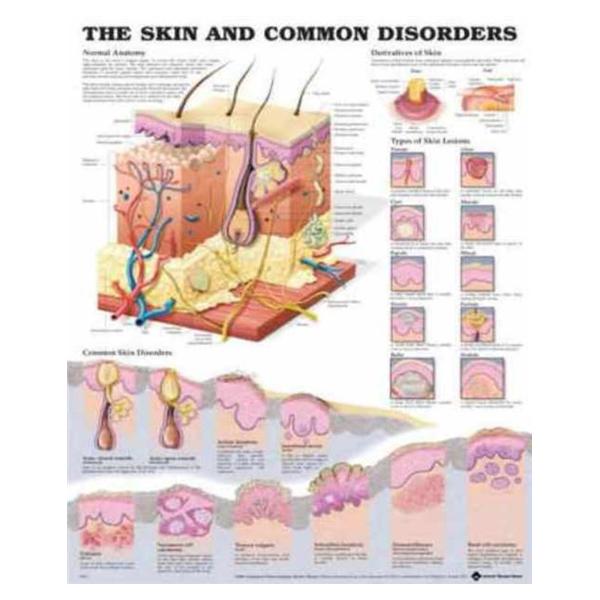 Chart Educational Common Skin Disorders 20x26\