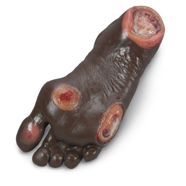 Foot Pressure Ulcer Model Anatomical Elderly Ea