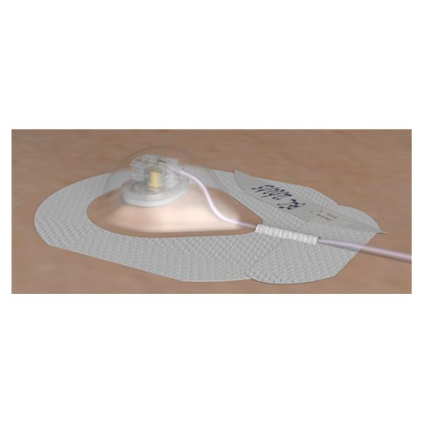 Kit Port Access AllPoints 20gx1