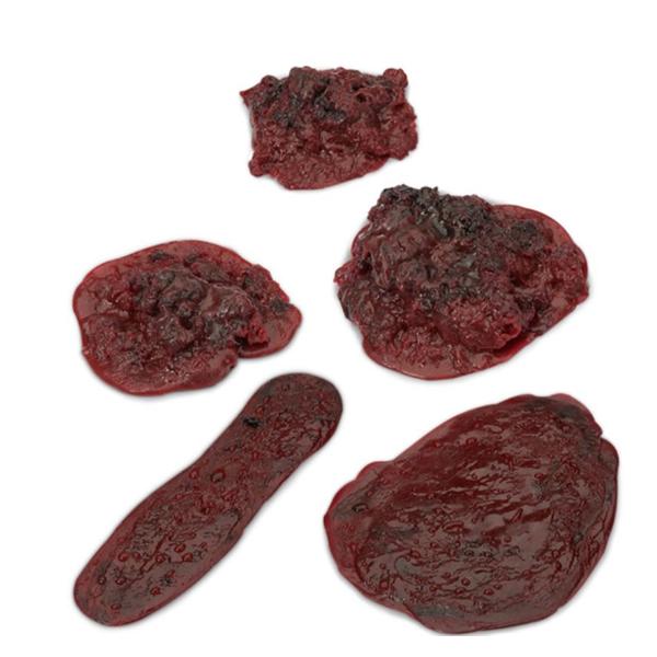 Clot/Hemorrhage Model Set Life/form Each