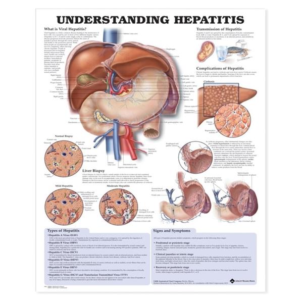 Chart Educational Understanding Hepatitis 20x26\