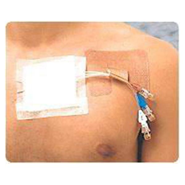 Fastener Catheter Cath-Strip 1/Pouch 50/Ca