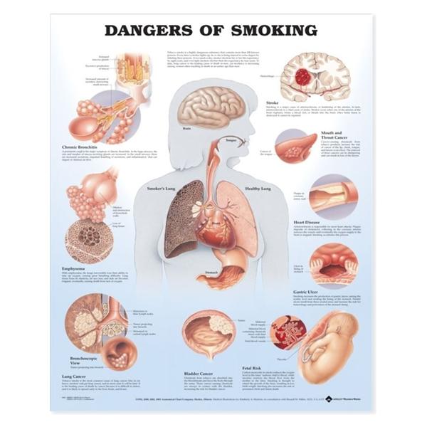 Chart Educational Dangers of Smoking 20x26\