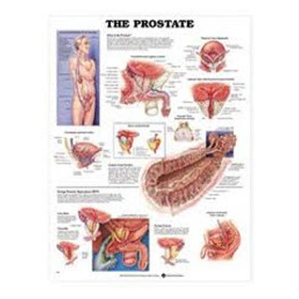 Chart Anatomical Prostate Laminated 20x26\